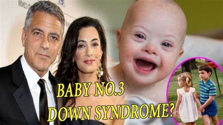 Inside The Rumors Of A Clooney Twin With Down Syndrome
