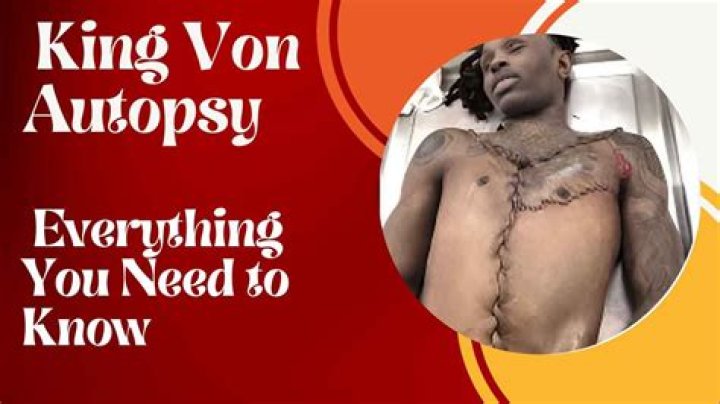 King Von Autopsy Reveals Startling Insights
